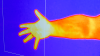 An arm and hand as viewed by an infra red camera