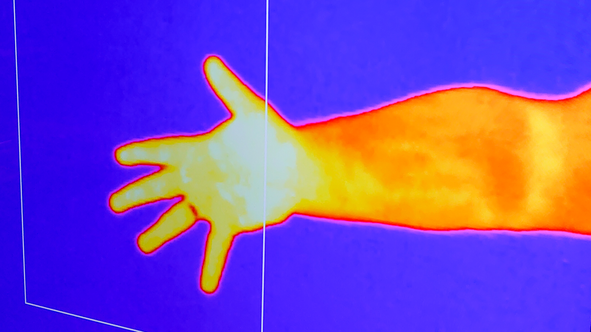 An arm and hand as viewed using an infra-red camera