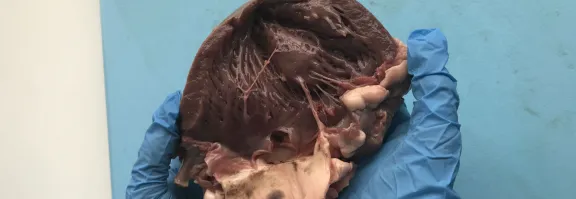 Heart for dissection