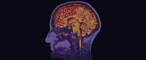 The inside of a human head is revealed by an MRI scan