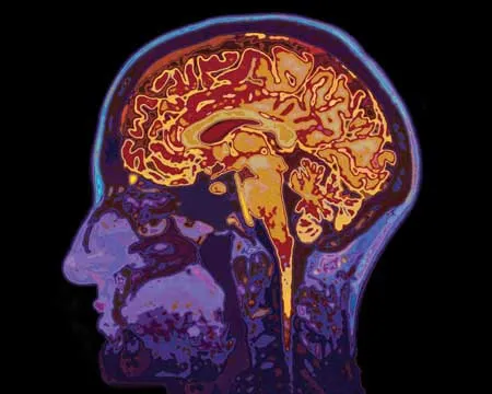 The inside of a human head is revealed by an MRI scan