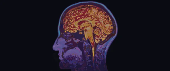 A scan of a human head shows the brain and other internal structures
