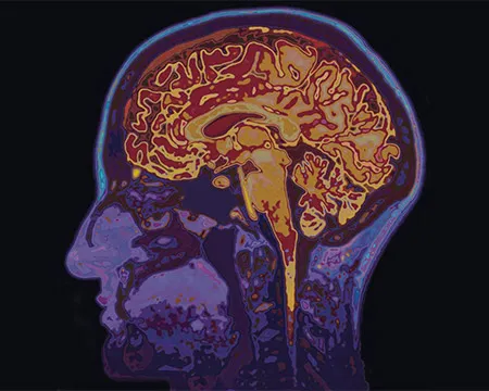 A scan of a human head shows the brain and other internal structures