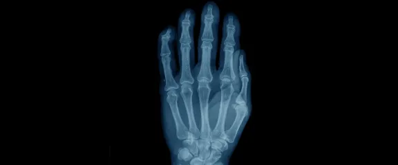 A scan of a hand 