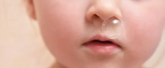 A bubble of snot emerges from a child's nostril